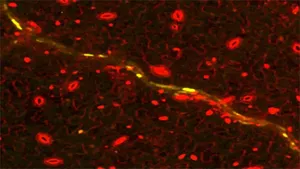 Expression of immunity genes (yellow) in plant tissue