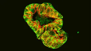 Mitochondrien-Störung führt zu verändertem Mikrobiom